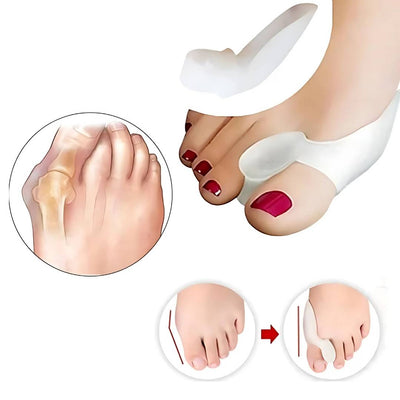 BunionGuard pour Hallux Valgus | Protection en silicone avec écarteur d’orteils – Soulagement de la douleur et alignement correctif